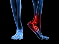 Ankle Tendonitis May Be A Common Form of Foot Pain