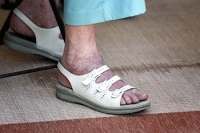 The Significance of Purple, Black, and Blue Feet in the Elderly