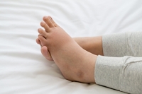 Battling Swollen Feet During Pregnancy